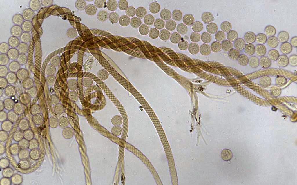 Prototrichia cf metallica